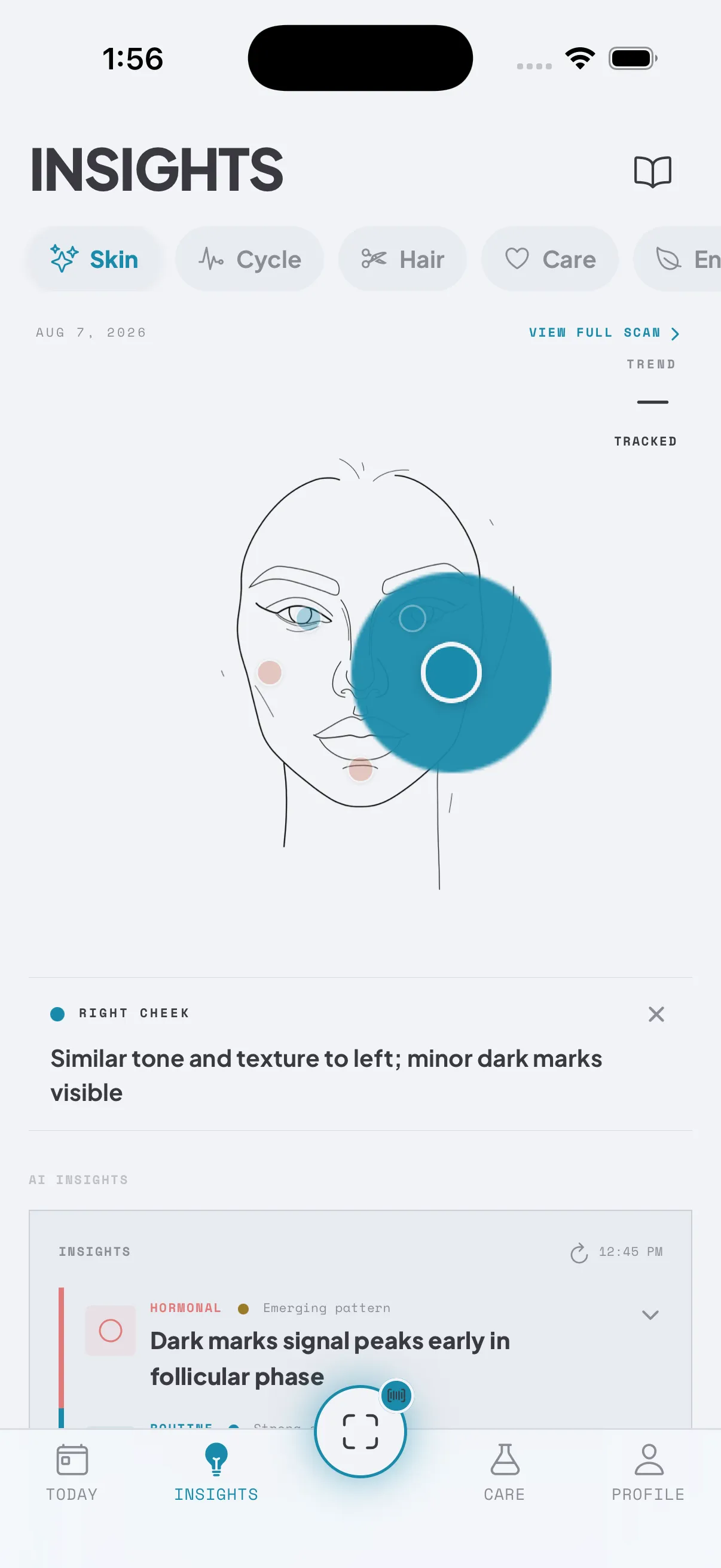 The SEQUEN skin view showing per-zone tracking on a face map with a top finding of tone