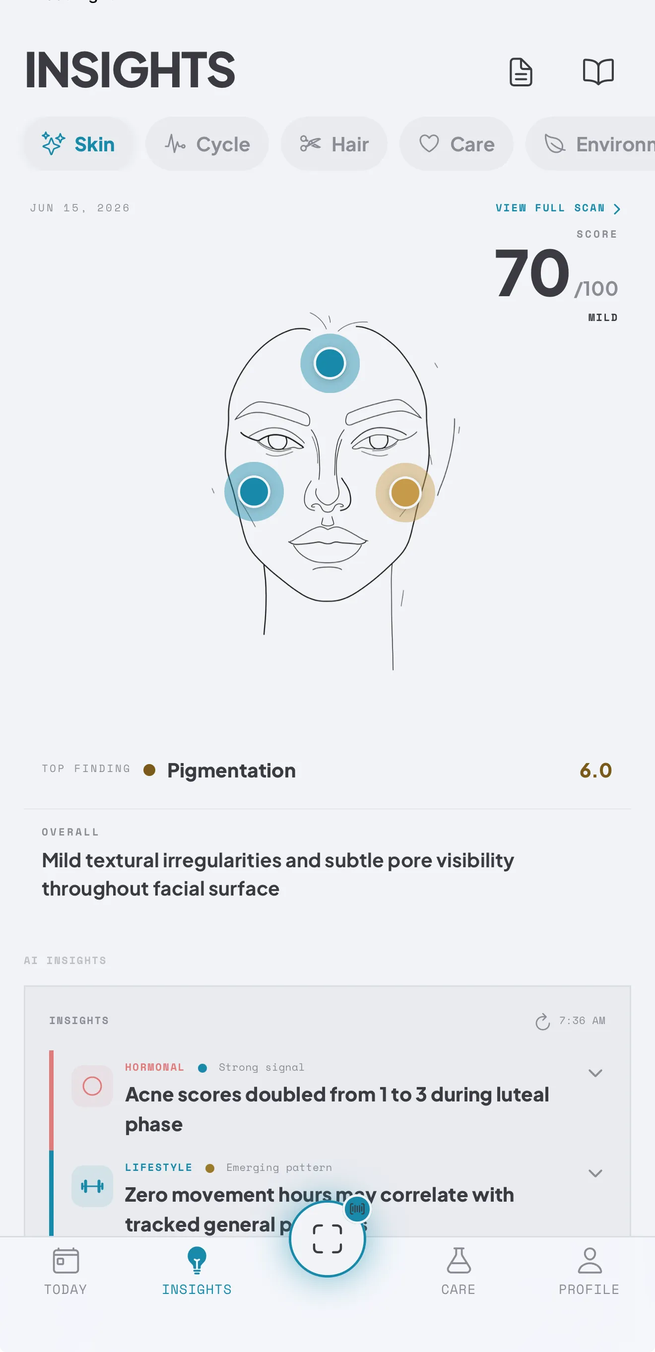 The SEQUEN skin view showing per-zone scoring on a face map with a top finding of pigmentation